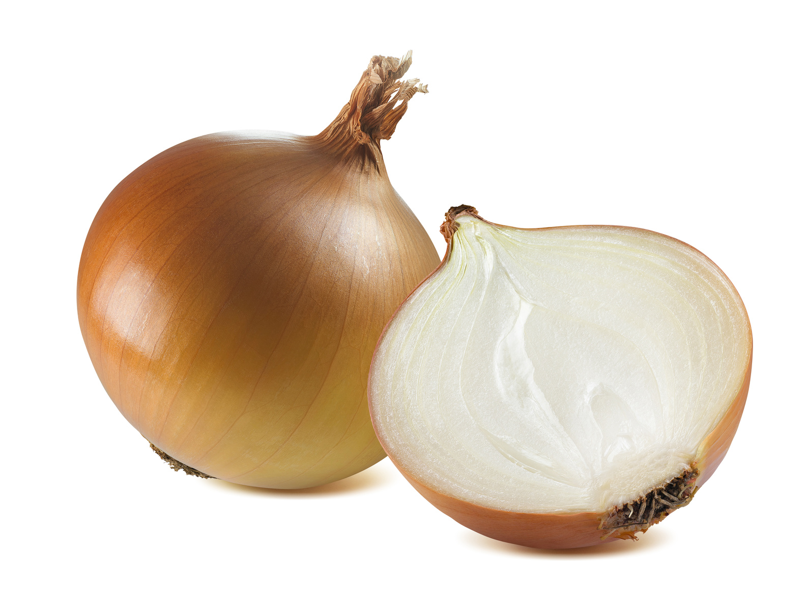 Metzger Zwiebel 25kg